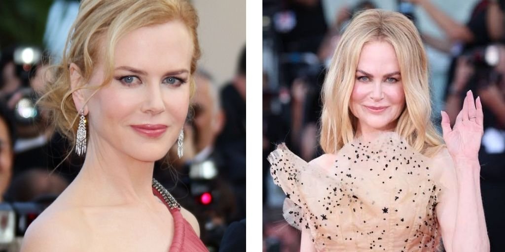 Nicole Kidman